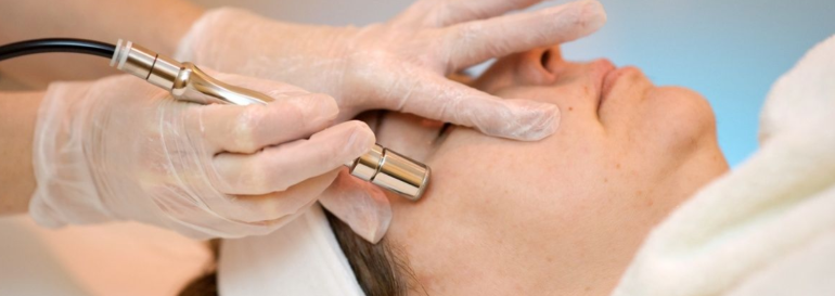 Microdermabrasion Treatment